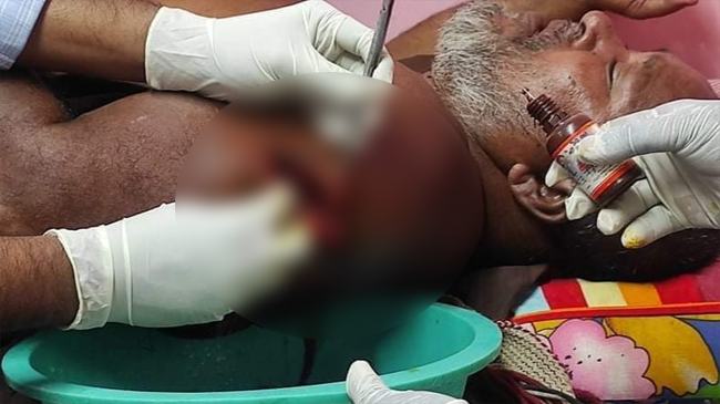 এবার বরগুনায় ইউপি সদস্যকে প্রকাশ্যে কোপাল দুর্বৃত্তরা