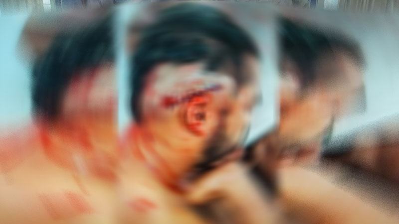 নারায়ণগঞ্জে ব্যবসায়ীকে কুপিয়ে ৫ লাখ টাকা ছিনতাই