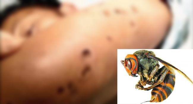 সখীপু‌রে ভিমরুলের কাম‌ড়ে ২ শিশুর মৃত্যু