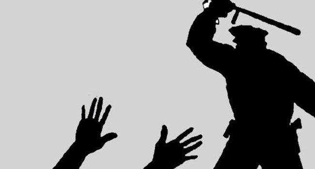 রিমান্ডের কিছু কি হবে?