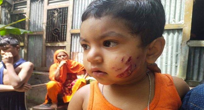 শ্রীনগরে কুকুরের কামড়ে শিশুসহ আহত ৬