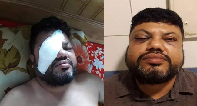 ব্যাংক কর্মকর্তাকে মারধর করলেন আ’লীগের নেতার ভাই