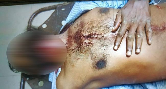 মেয়ে হত্যার মামলা করায় বাবাকেও হত্যাচেষ্টা