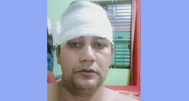 কোম্পানীগঞ্জে যুবলীগ নেতার হামলায় সাংবাদিক আহত