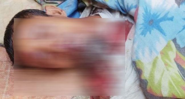 বদলগাছীতে সড়ক দুর্ঘটনায় ভ্যানচালক নিহত