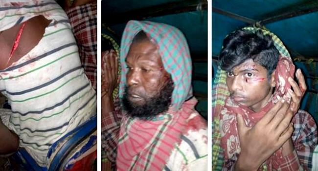 পাওনা টাকা চাওয়ায় রিক্সাওয়ালাকে কোপালেন যুক্তরাজ্য প্রবাসী