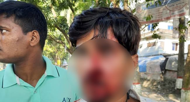 সিংড়ায় ছাত্রলীগ নেতাকে কুপিয়ে জখম