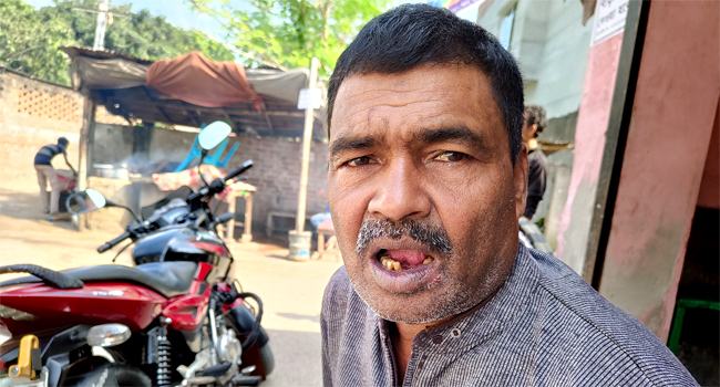 বোনের সাথে ঝগড়া, দুলাভাইয়ের ৩ দাঁত ভাঙলেন শ্যালিকা