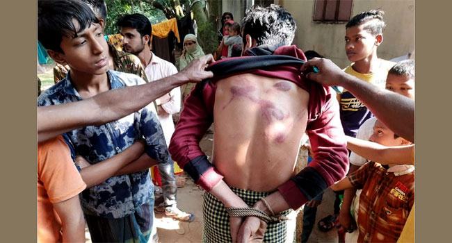মোবাইল চুরির অপবাদে বিবস্ত্র করে যুবককে নির্যাতন!