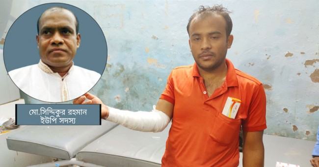 ঘুষের আলোচনা করায় চা-বিক্রেতাকে ফুটন্ত পানিতে দগ্ধ করলেন মেম্বার