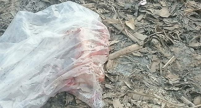 মহাসড়কের পাশে পলিথিনে মোড়ানো কাটা পা