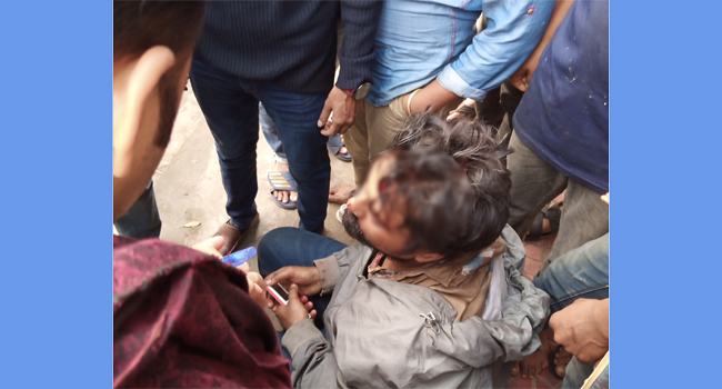 হিজড়ার হামলায় ঢাবি কর্মকর্তার ছেলে আহত