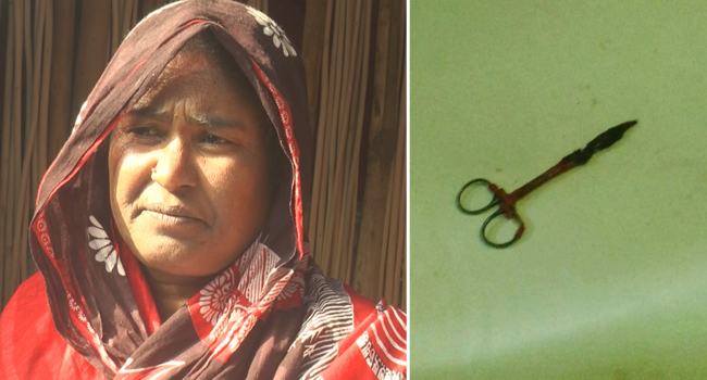 নারীর পেট থেকে ২০ বছরের পুরোনো সার্জিক্যাল আটারি অপসারণ