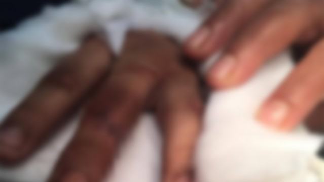আদালতে হাজিরা দিতে এসে হাতের চারটি আঙ্গুল খোয়াল আসামি