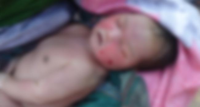 প্রসবের সময় নার্সের টানা-হেঁচড়ায় নবজাতকের মৃত্যু