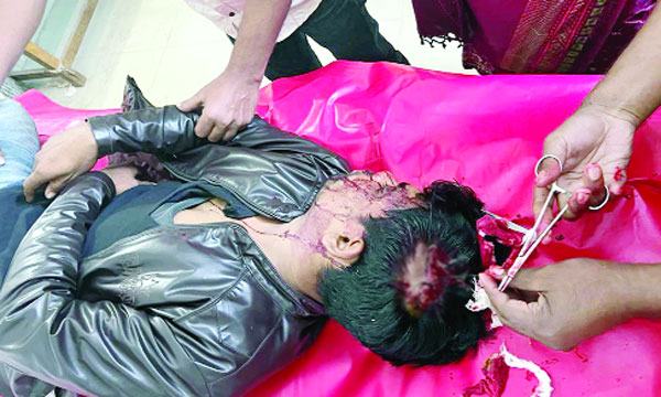 দেবিদ্বারে নৌকা সমর্থকদের হামলায় স্বতন্ত্র প্রার্থীর ১২ কর্মী আহত