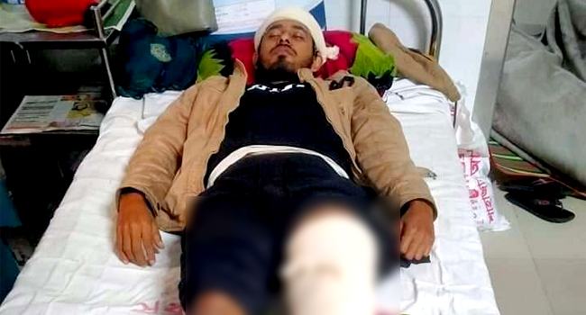 রড দিয়ে পিটিয়ে যুবকের পা ভাঙ্গলো চাচাতো ভাই