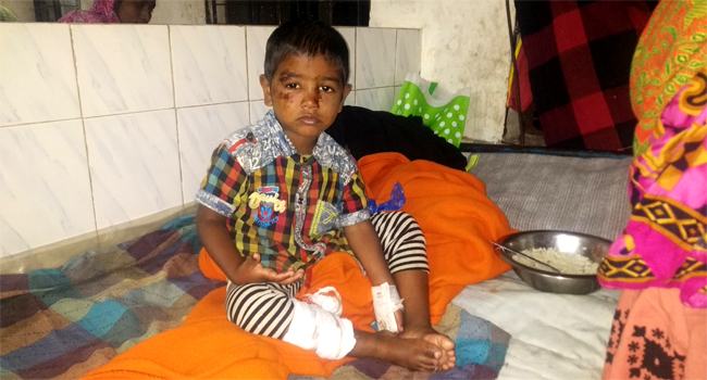 পাথরঘাটায় ৩ দিনে কুকুরের কামড়ে শিশুসহ আহত ১৬