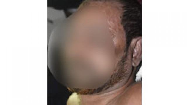 নির্বাচনী সহিংসতা : সাতকানিয়ায় সংঘর্ষে নিহত ১