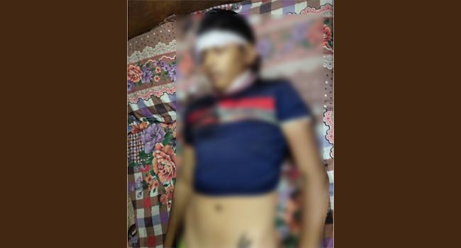 ইউপি নির্বাচন : সাতকানিয়ায় বিভিন্ন ইউনিয়নে সংঘর্ষ-গোলাগুলি, নিহত ১