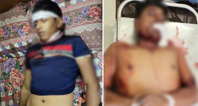 সাতকানিয়ায় নির্বাচনী সহিংসতায় নিহত ২, আহত অর্ধশতাধিক