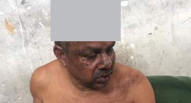 লঞ্চে অগ্নিকাণ্ড : স্ত্রীর পর এবার মারা গেলেন শিক্ষক বঙ্কিম চন্দ্র