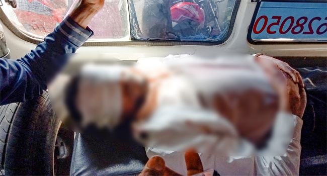 গ্রাম্য দলাদলি : প্রতিপক্ষকে চোখে ভোমর দিয়ে খুঁচিয়ে জখম