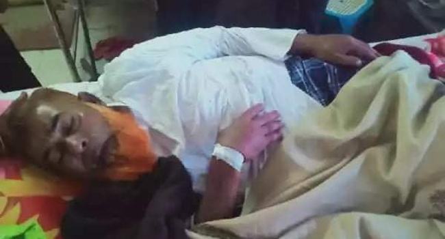 সালথায় প্রতিপক্ষের হামলায় প্রবীণ আ’লীগ নেতা আহত