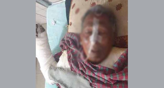 যশোরে আগুন পোহাতে গিয়ে বৃদ্ধের মৃত্যু