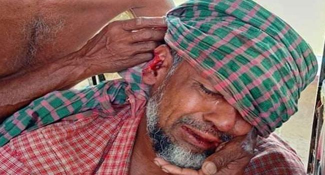 জমি নিয়ে বিরোধের জেরে দুলাভাইয়ের কান কামড়ে নিল শ্যালক