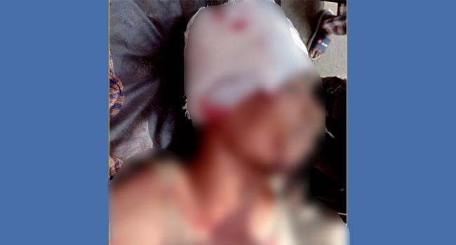 নৌকার পক্ষে কাজ করায় সাতকানিয়ায় দুই আ’লীগ নেতাকে পিটিয়ে আহত