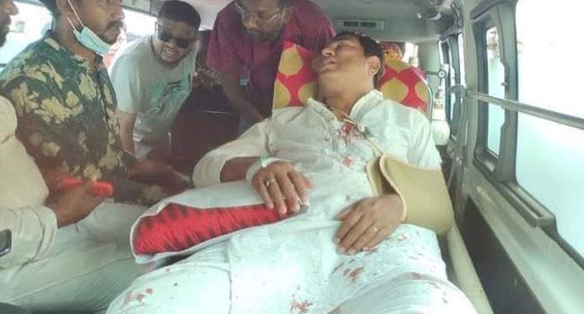 সড়ক দুর্ঘটনায় আহত বরগুনার মেয়র