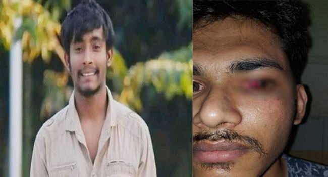 ছাত্রলীগ নেতাকে ‘তুমি’ সম্বোধন করায় শিক্ষার্থীকে মারধরের অভিযোগ