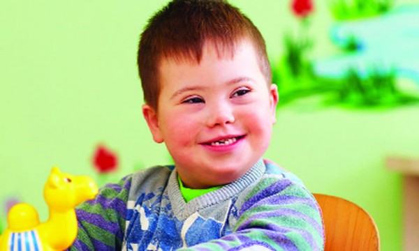 ডাউন সিন্ড্রোম প্রতিরোধেই মুক্তি