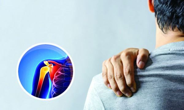 ফ্রোজেন শোল্ডারের চিকিৎসা