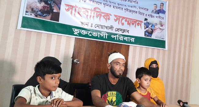 এমপির ইফতারে যাওয়ায় ছাত্রলীগ নেতাকে হাতুড়িপেটা
