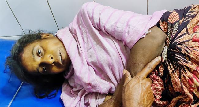 ফুলবাড়ীতে রেলে পা-কাটা নারীর পরিচয় মেলেনি