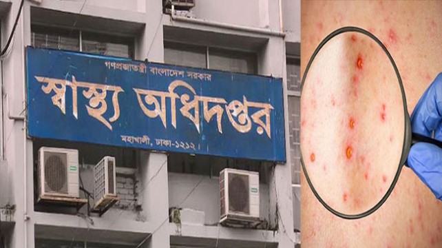 `মাঙ্কিপক্স' নিয়ে দেশের সব বন্দরে সতর্কতা
