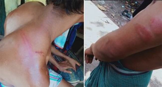 পাহাড়ি সন্ত্রাসীদের বিরুদ্ধে বাগান মালিক ও শ্রমিক অপরহরণের অভিযোগ