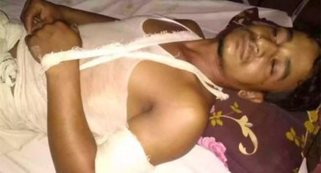 করিমগঞ্জে যুবককে কুপিয়ে জখম