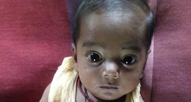 শিশু বায়েজিদকে বাঁচাতে এগিয়ে আসুন