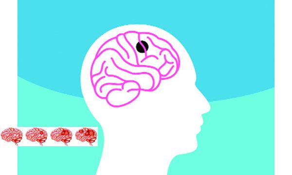 ব্রেন টিউমারে করণীয়