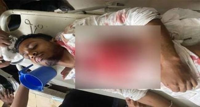 নোয়াখালীতে ছাত্রদল কর্মীকে কুপিয়ে জখম