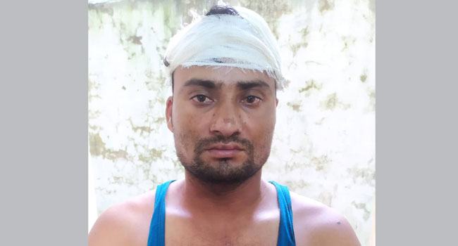 কোরবানির গরুর দাম কম বলায় প্রবাসীর মাথা ফাটিয়ে দিলো সাবেক মেম্বার!