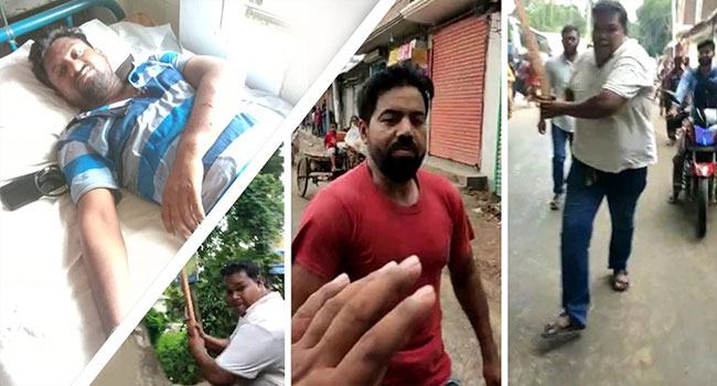 ফরিদপুরে পৌর মেয়রের ভাইয়ের বেধড়ক পিটুনিতে গুরুতর আহত সাংবাদিক