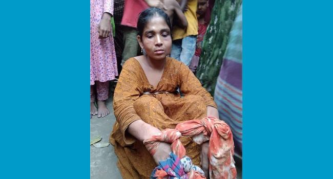 দেবিদ্বারে নির্যাতন সইতে না পেরে স্বামীর গোপনাঙ্গ কাটলেন স্ত্রী