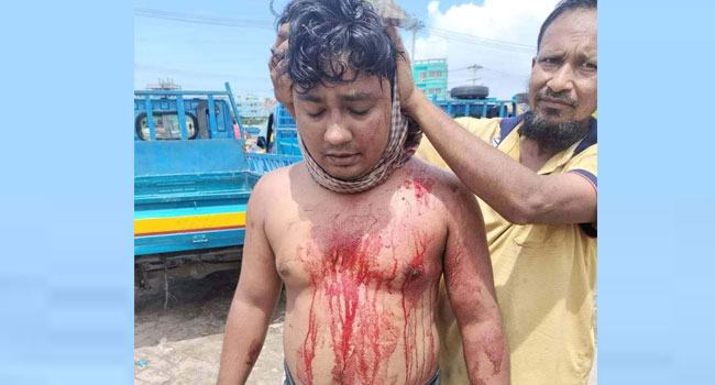 সোনারগাঁওয়ে ছাত্রদল নেতার ওপর সন্ত্রাসী হামলা