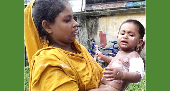 নাজিরপুরে গরম ডালে ঝলসে যাওয়া শিশুর মৃত্যু