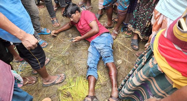 আ’লীগ কর্মীদের বিরুদ্ধে যুবদল নেতার পা ভেঙে দেয়ার অভিযোগ
