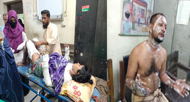 গলাচিপায় স্বামী-স্ত্রী দুইজনই আগুনে পুড়ে দগ্ধ